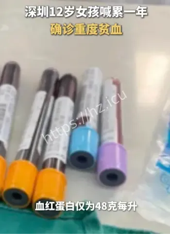 12岁女孩重度贫血