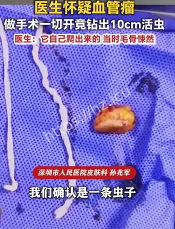 手臂肿块钻出活虫